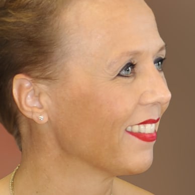 Inge Jacobsen
