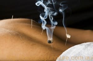 C:\fakepath\BusinessPhoto1_BestAcupuncture.jpg C:\fakepath\BusinessPhoto1_BestAcupuncture.jpg