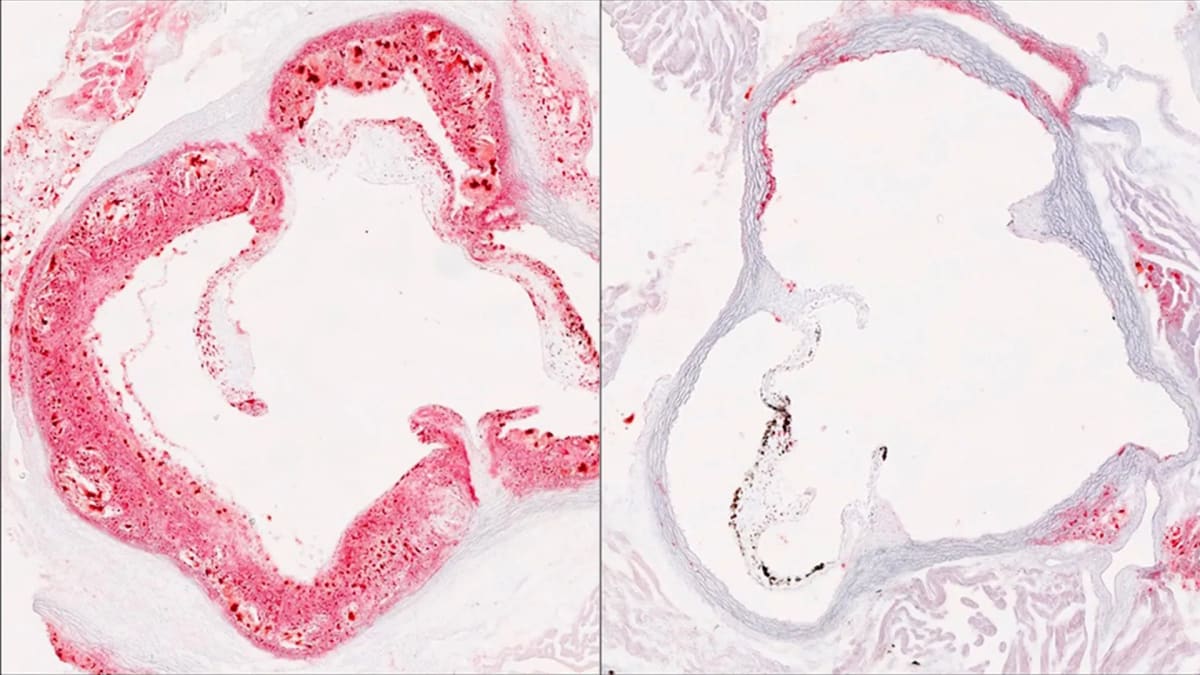 Breakthrough Discovery: Scientists Identify Liver Protein That Could Transform Cholesterol Management