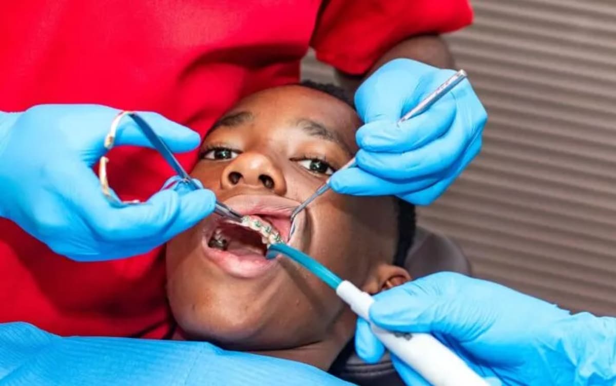 Nigeria Faces Critical Shortage of Orthodontists as Healthcare Workers Migrate Abroad