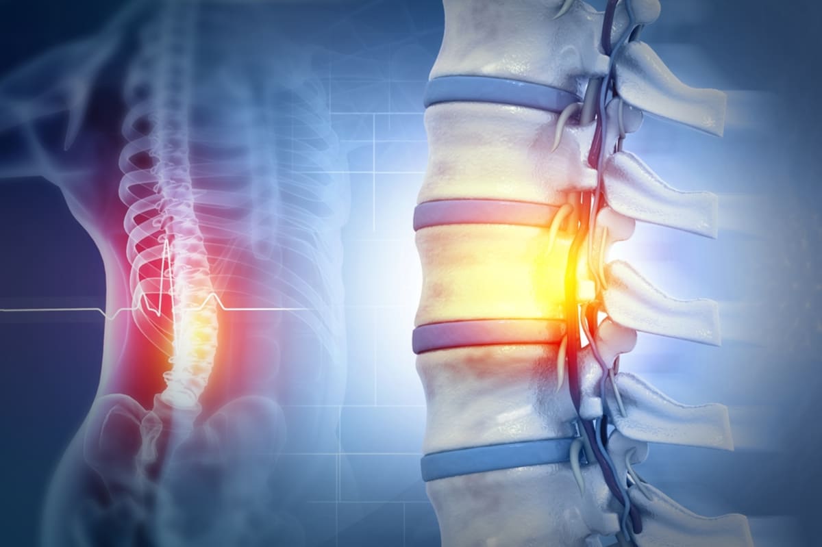 New Patient Reported Tool Validates Hypotension Symptoms in Spinal Cord Injury: A Breakthrough for Remote Monitoring