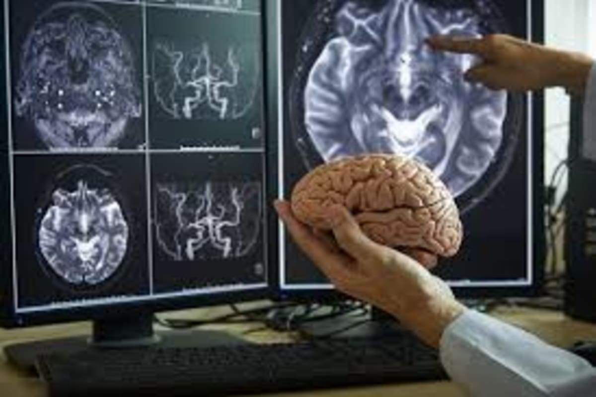 Human Brain Mirrors AI in Predicting Words Before They Are Spoken, Study Reveals