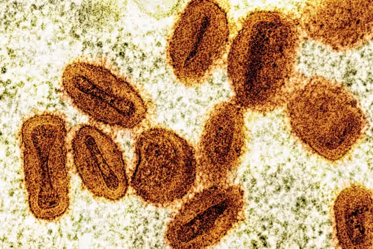 US Scientists Charged With Smuggling Deactivated Mpox Virus Into Country