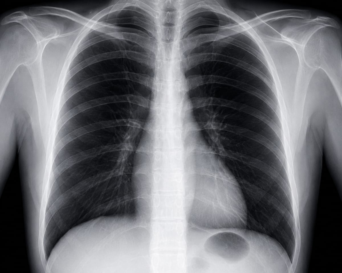 FDA Fast Tracks Generative AI Tools for Radiology: A Breakthrough in Diagnostic Efficiency