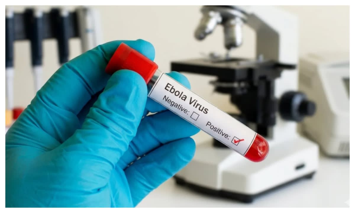 Ebola and Malaria Share Overlapping Symptoms in Early Stages, Nigerian Doctors Warn