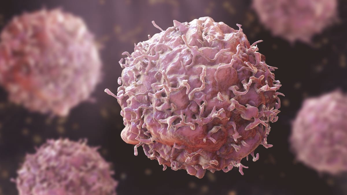 Rising Cancer Rates in Young Nigerians: Lifestyle and Prevention Strategies