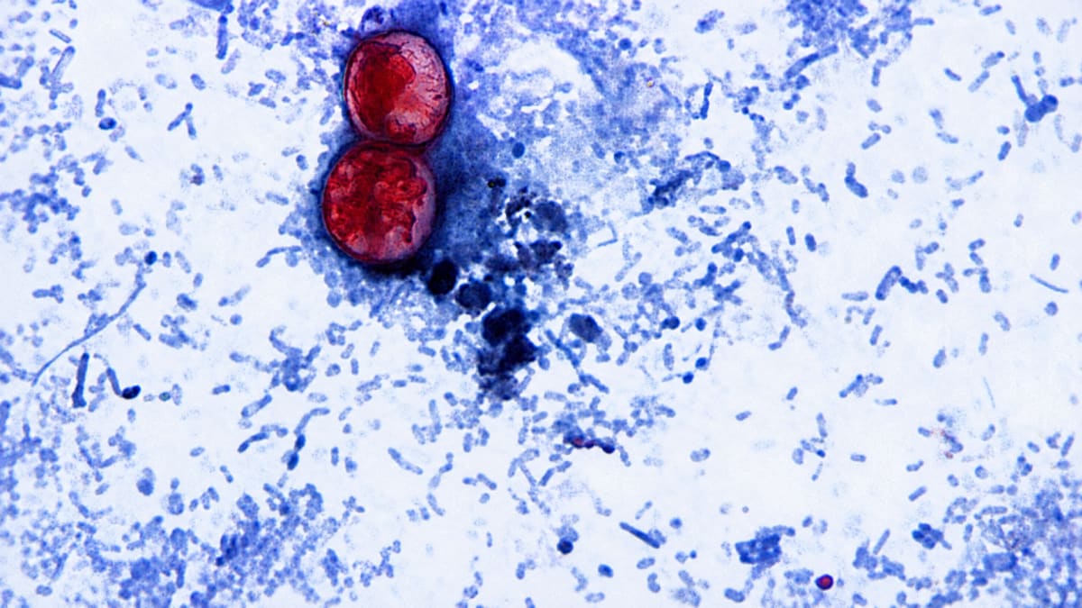 Cyclospora Outbreak Mystery: Why Public Health Delays Leave Consumers in the Dark