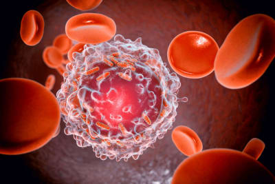Pediatric Leukemia Treatment Shows Promise but Carries Early Inflammatory Risks, Study Finds