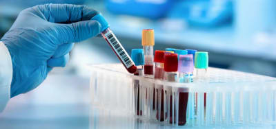 Diagnostic Desert: 80% of Africans Denied Basic Medical Testing at Primary Care Level