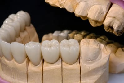 AI designed dental crowns show promise but still need human oversight