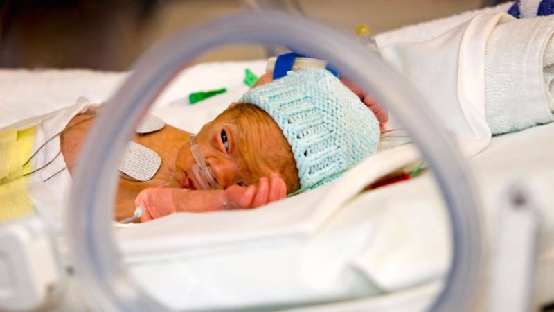 Extreme Prematurity and the Brain: How Early Birth Disrupts Neural Development