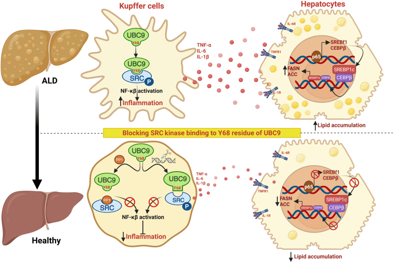 Breakthrough in Alcohol Associated Liver Disease: Researchers Uncover Molecular Triggers of Inflammation