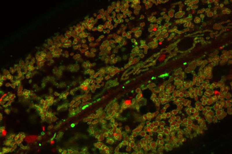 Leucine emerges as key nutrient for mitochondrial energy boost, study reveals