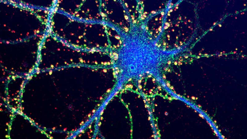 Neuroscientists Identify Brain Circuit That Translates Goals Into Physical Action