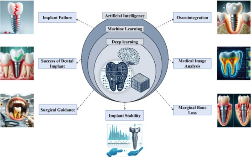 How Machine Learning Is Revolutionizing Titanium Implant Manufacturing for Medical Use