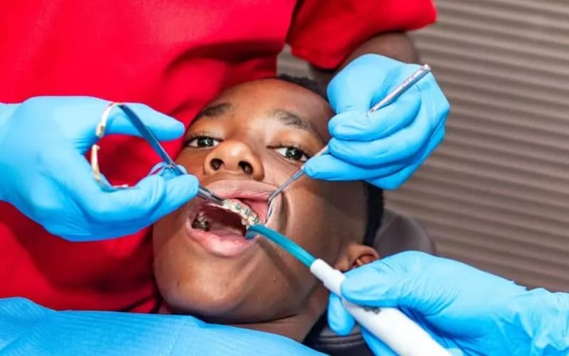 Nigeria Faces Critical Shortage of Orthodontists as Healthcare Workers Migrate Abroad
