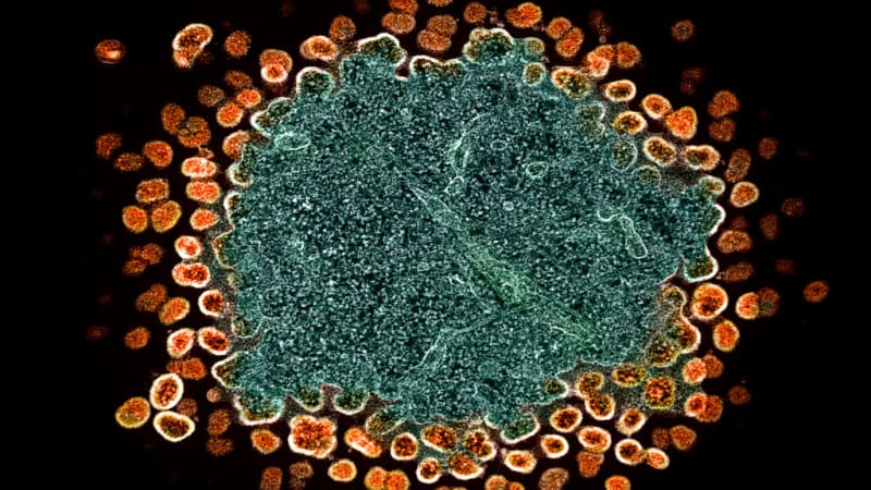 HIV’s Hidden Sanctuary: Researchers Identify New Viral Reservoir That Could Reshape Treatment Strategies