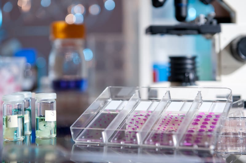 Breakthrough in Triple Negative Breast Cancer: How LIG1 Loss Could Reshape Treatment Strategies