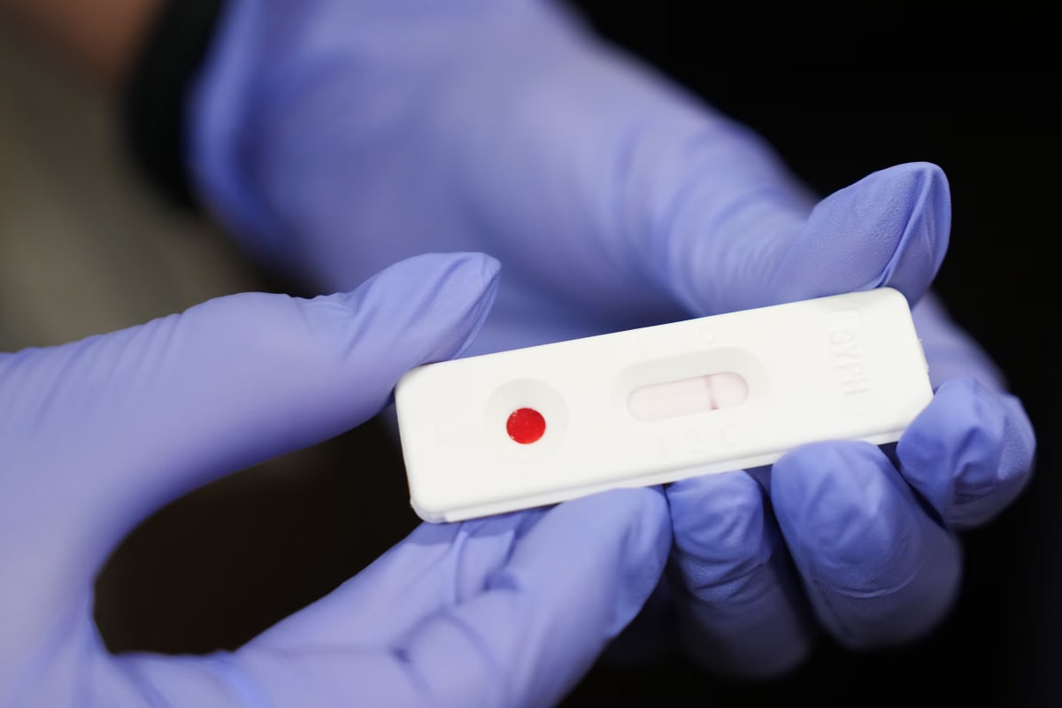 STI cases remain elevated despite recent declines, CDC data reveal persistent public health challenge