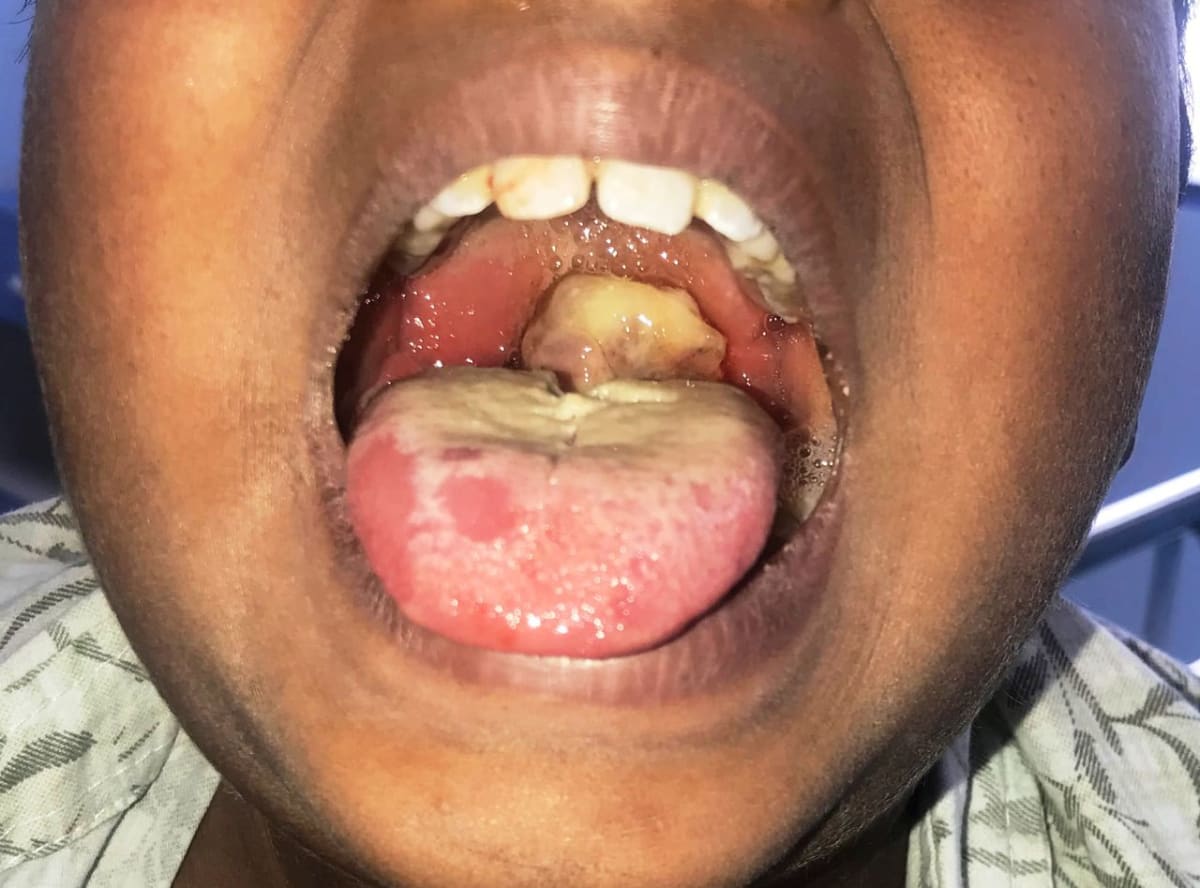 Suspected Diphtheria Outbreak in Niger State Claims Child’s Life as Health Authorities Mobilize Response