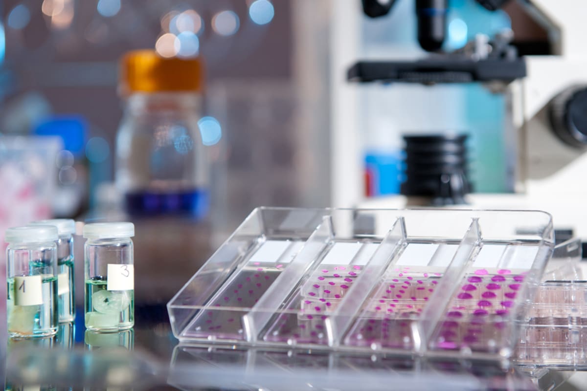 Breakthrough in Triple Negative Breast Cancer: How LIG1 Loss Could Reshape Treatment Strategies