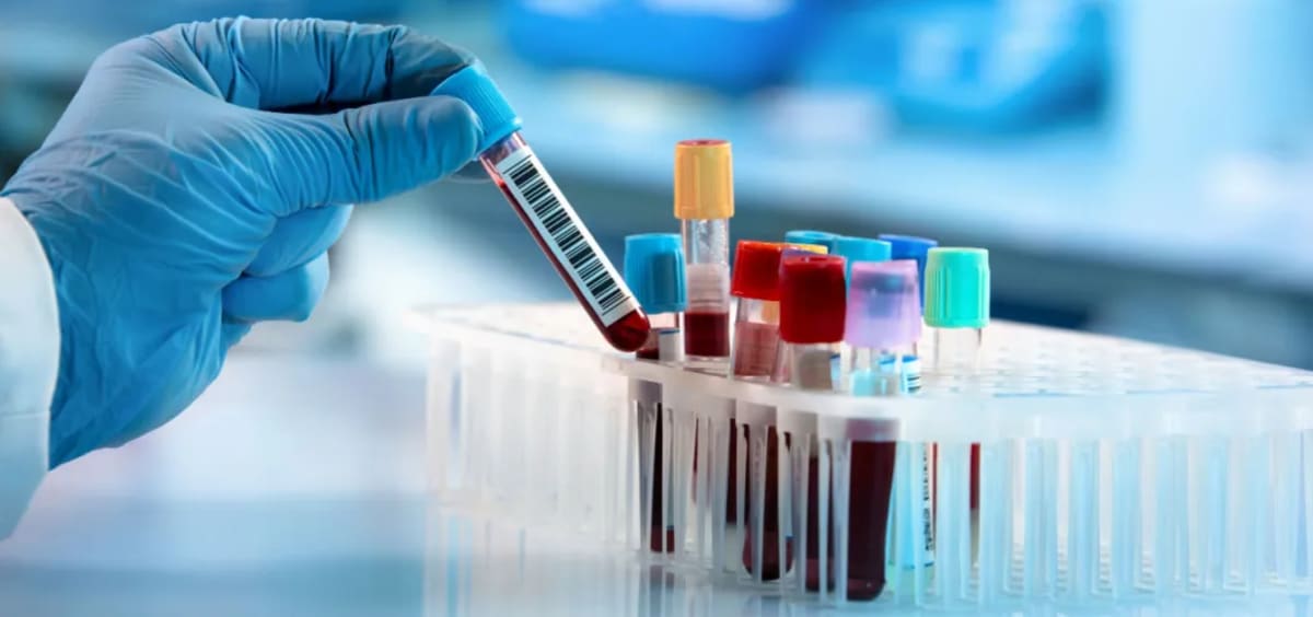 Diagnostic Desert: 80% of Africans Denied Basic Medical Testing at Primary Care Level