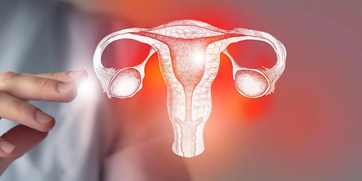 Repurposed Cholesterol Drug Shows Promise in Disrupting Ovarian Cancer’s Protective Tumor Microenvironment