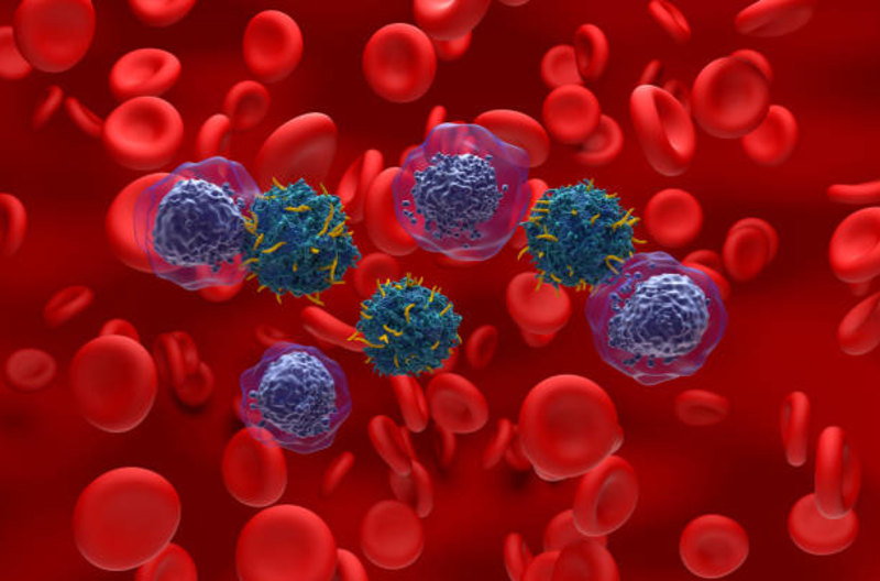 Precision CAR T Therapy for AML Preserves Healthy Blood Cells in Early Trials