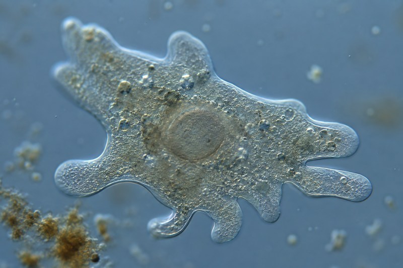 Deadly 'Brain Eating Amoeba': What Families Need to Know After Tragic Death Highlights Rare but Fatal Risk
