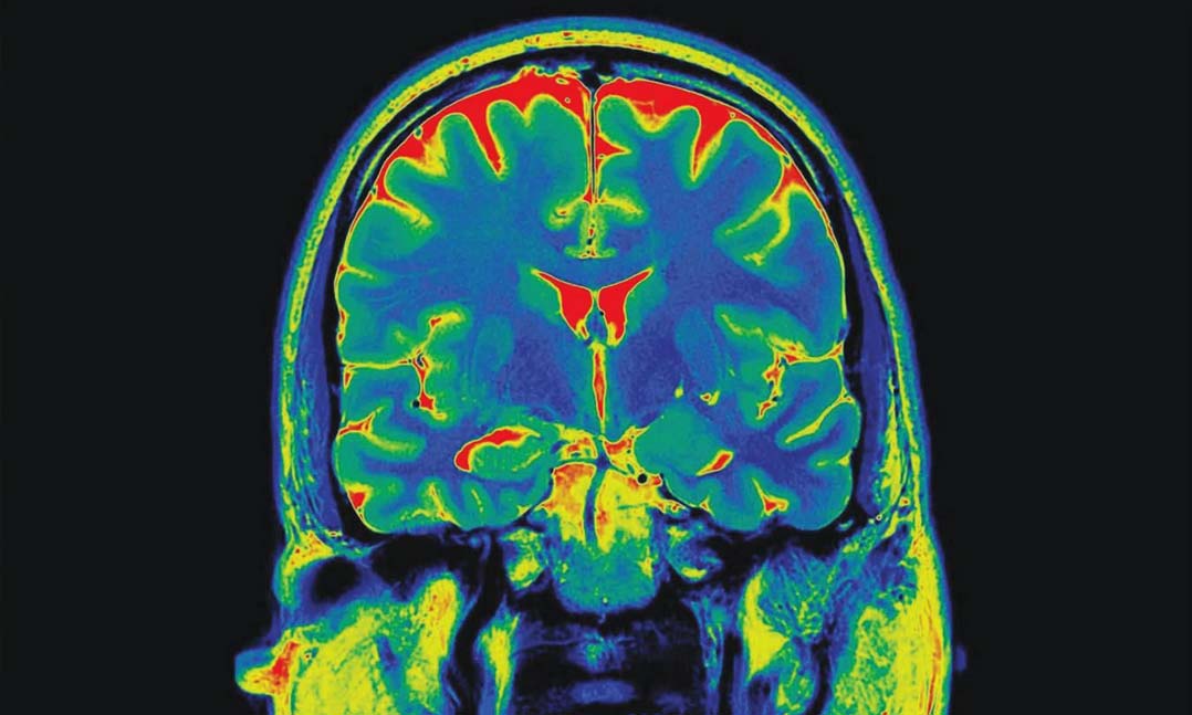 Understanding PTSD Research: Progress, Insights, and What It Means for Recovery