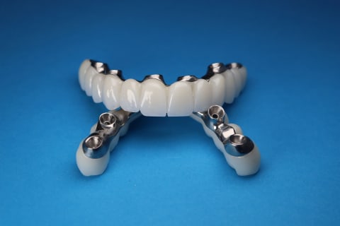 implant teeth