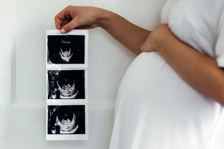 12 week ultrasound explained