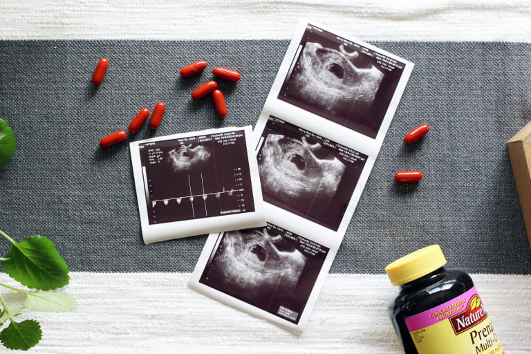 9 Best Prenatal Vitamins Of 2020