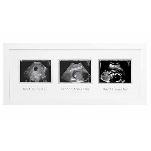 michaels ultrasound frame