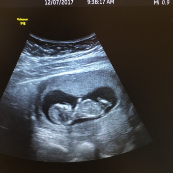 Nesia's Baby Registry Photo.