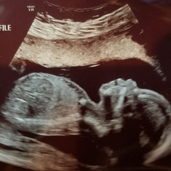 Jen's Baby Registry Photo.