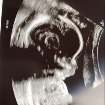 SauraE's Baby Registry Photo.
