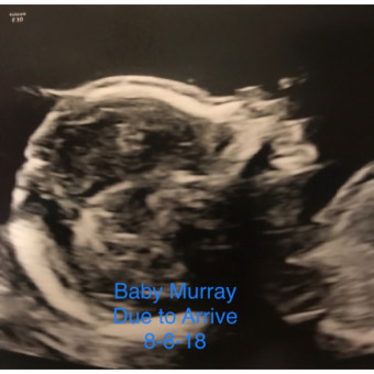Roxie Murray’s Baby Registry Photo.