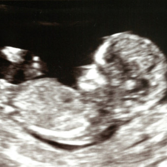 Baby Boy Hess Photo.