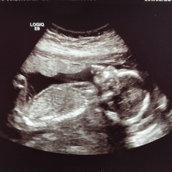 Baby Ziganto Registry Photo.