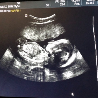 Babylist Registry Photo.