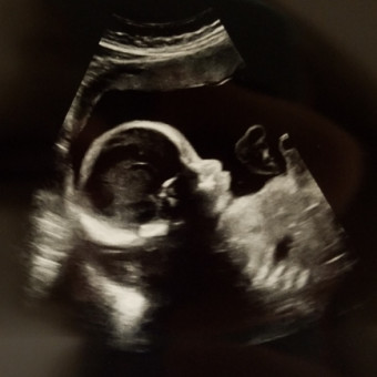 Baby Gadd 2018 Photo.