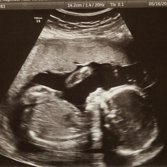 Baby O'Neill's Registry Photo.