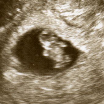 Baby Sasaki's Registry Photo.