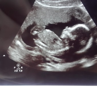 Brianna's Baby Registry Photo.