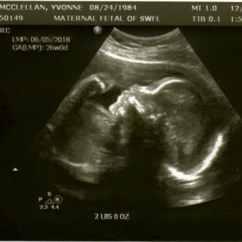 Babylist Registry Photo.