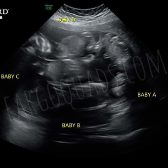 Babylist Registry Photo.