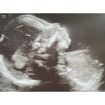 Babylist Registry Photo.