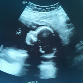 Babylist Registry Photo.