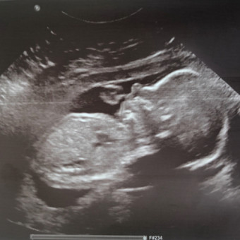 Babylist Registry Photo.
